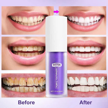 Dentifrice Blanchissant Violet,Blanchiment Dentaire Violet,Dents Blanches Violets,Dentifrice Blanchissant,Purple Teeth Whitening,Purple Toothpaste,Blanchiment Des Dents